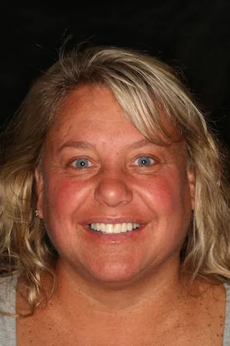 After image of a woman smiling