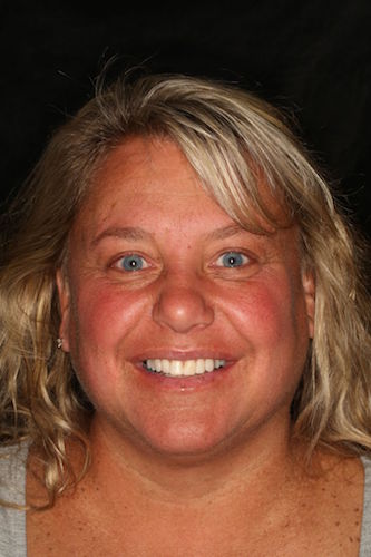 After image of a woman smiling
