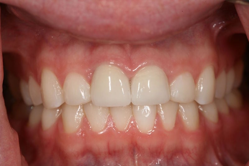 After image of a mouth