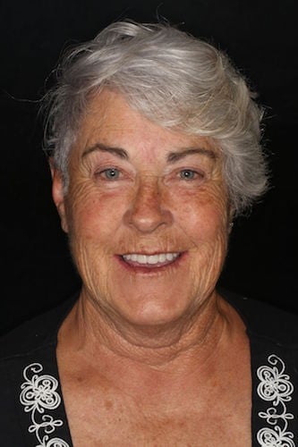 After image of a woman smiling