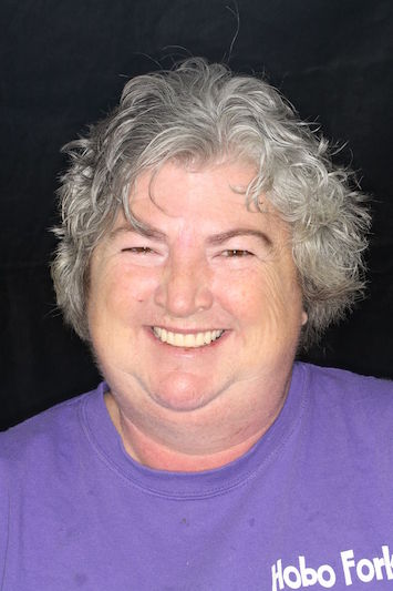 After image of a woman smiling with a great new smile