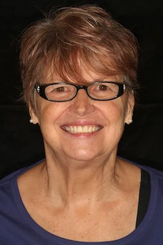After image of the woman smiling without a tooth gap