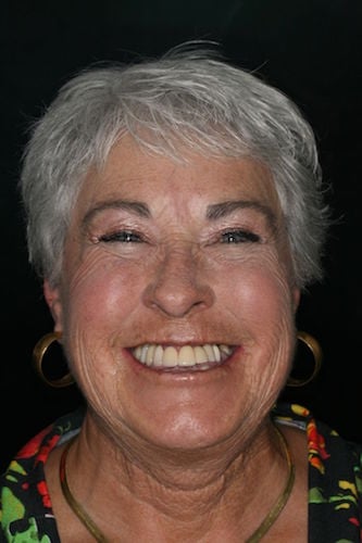 Before image of a woman