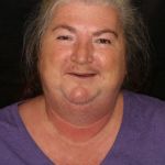 Before Image of a woman smiling, showing no teeth.