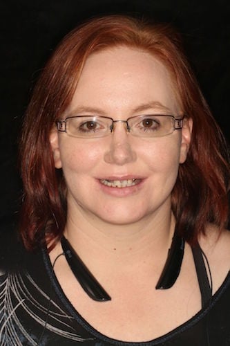Before image of a woman smiling with missing teeth
