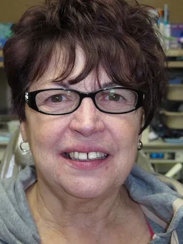 Before image of a woman with a gap between her front teeth