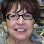 Before image of a woman with a gap between her front teeth
