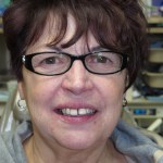 Before image of a woman with a gap between her front teeth
