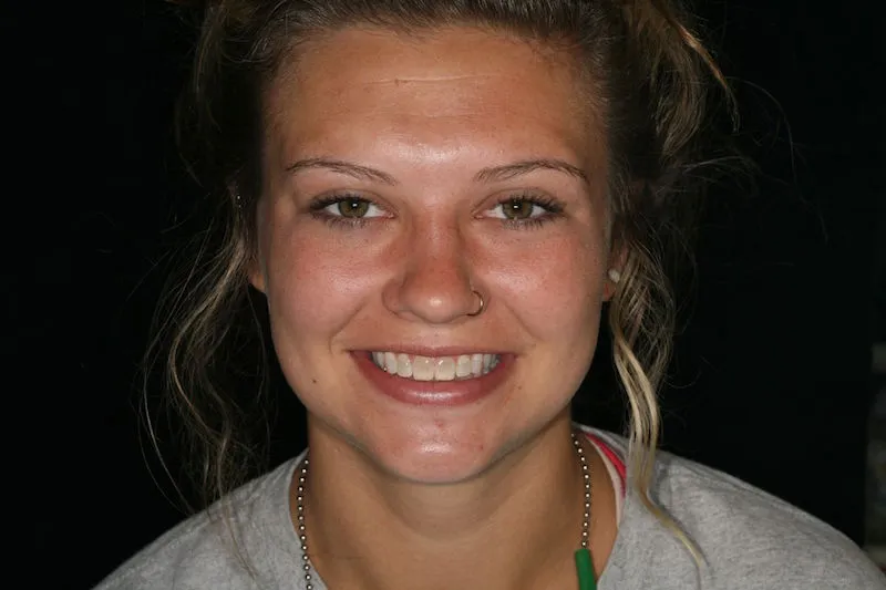 Young woman smiling before image